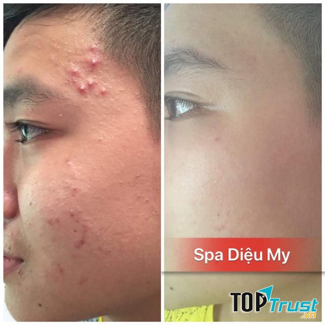Diệu My Spa