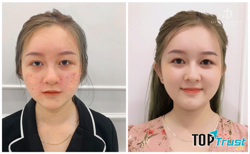 Viện Thẩm Mỹ DIVA - Đà Lạt