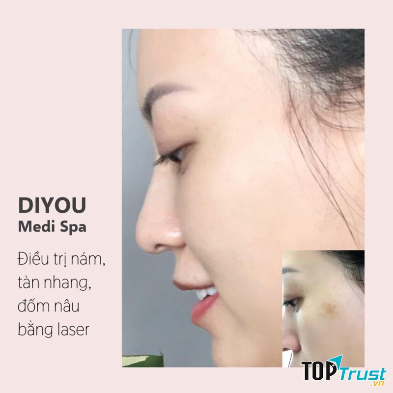 Diyou Medi Spa