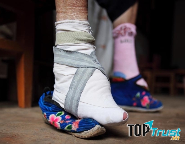 Để có thể đeo vừa những đôi giày sen, phụ nữ Trung Quốc thời bấy giờ phải bó chân