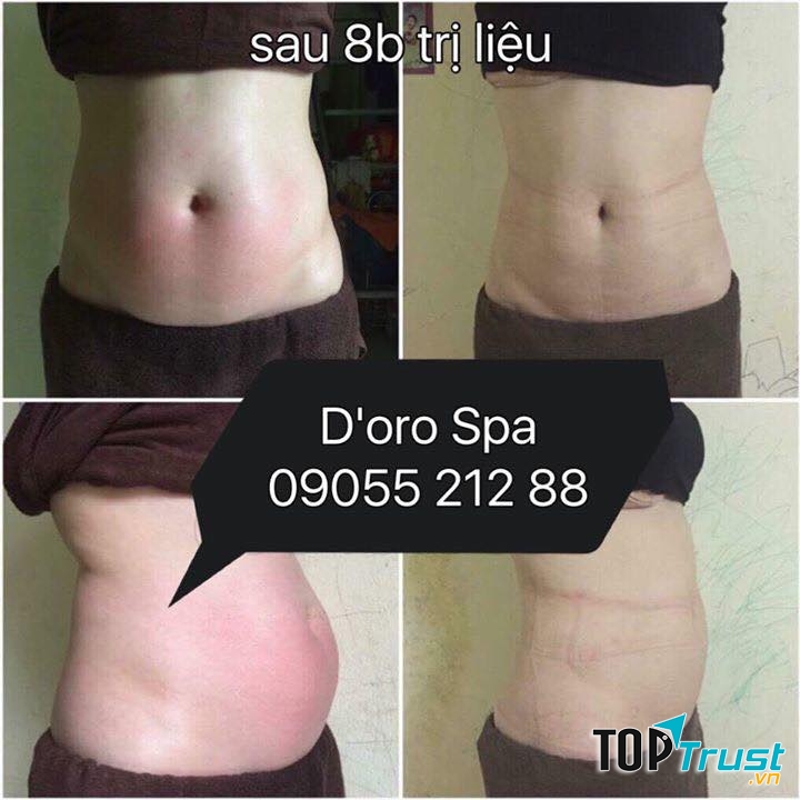 Hiệu quả rõ nét khi trải nghiệm liệu trình tại D'ORO Spa Đà Nẵng