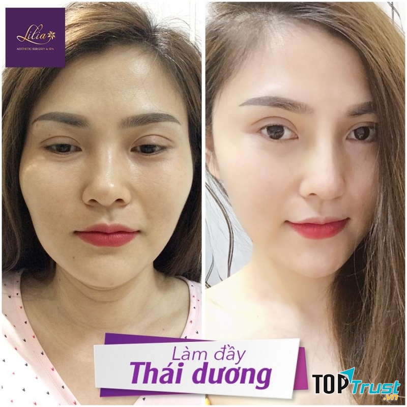 Dr Jang - Thẩm Mỹ Viện Lilia