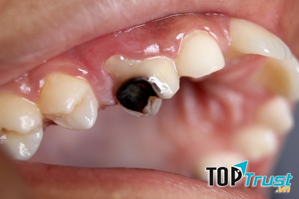 Ảnh minh họa - nguồn internet