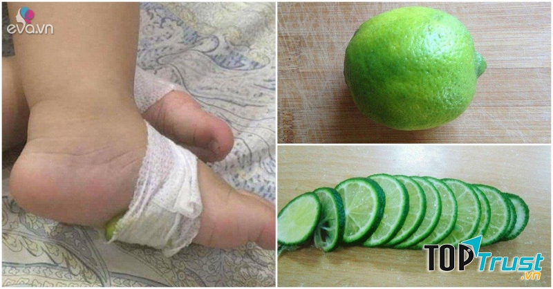 Dùng chanh tươi để hạ sốt, kể cả sốt cao