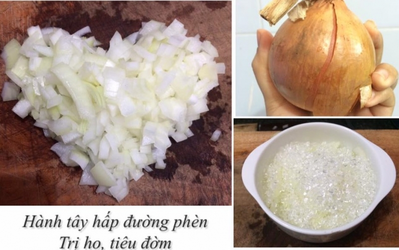 trị ho bằng hành tây và đường phèn