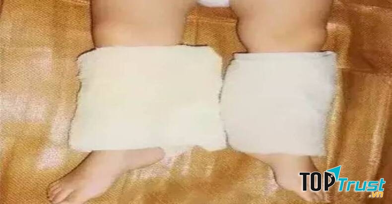 Dùng khăn hoặc tất ướt quấn quanh mắt cá chân