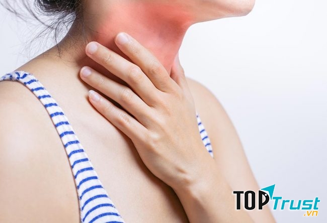 Điều trị viêm họng