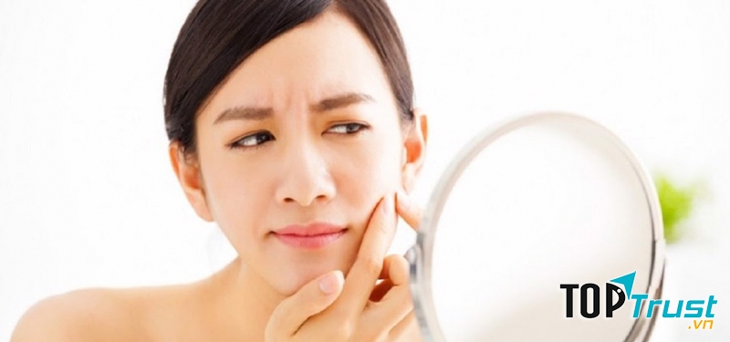 Đường gây ra mụn