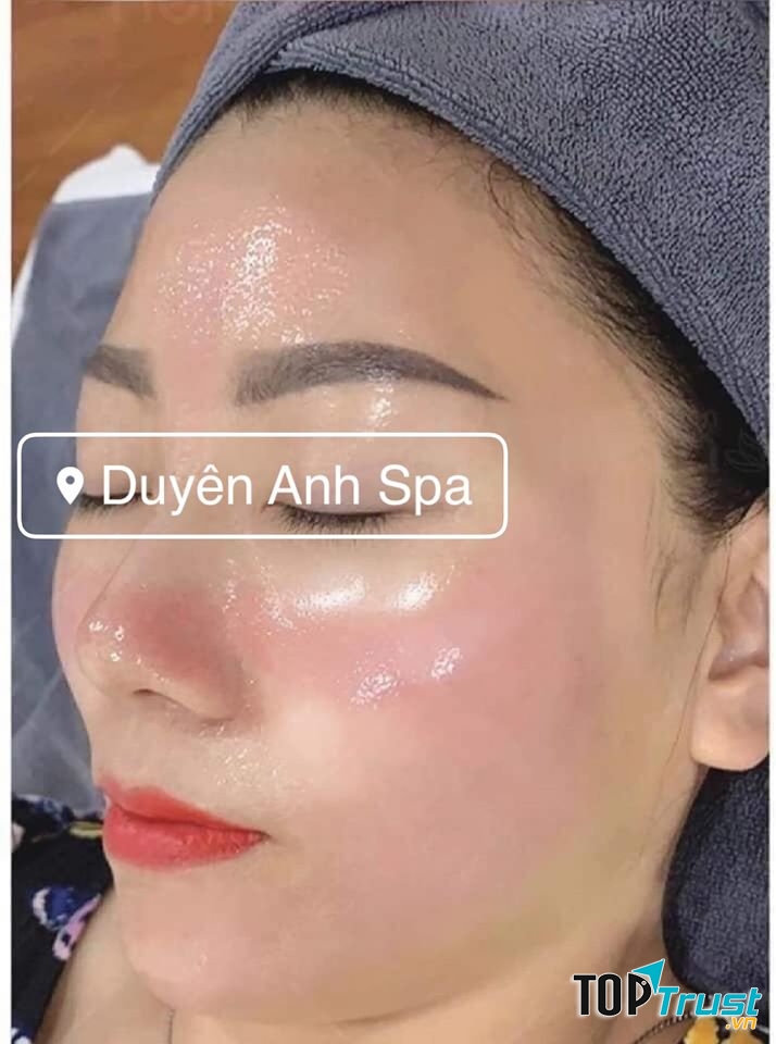 Duyên Anh Spa - Đặc trị về da