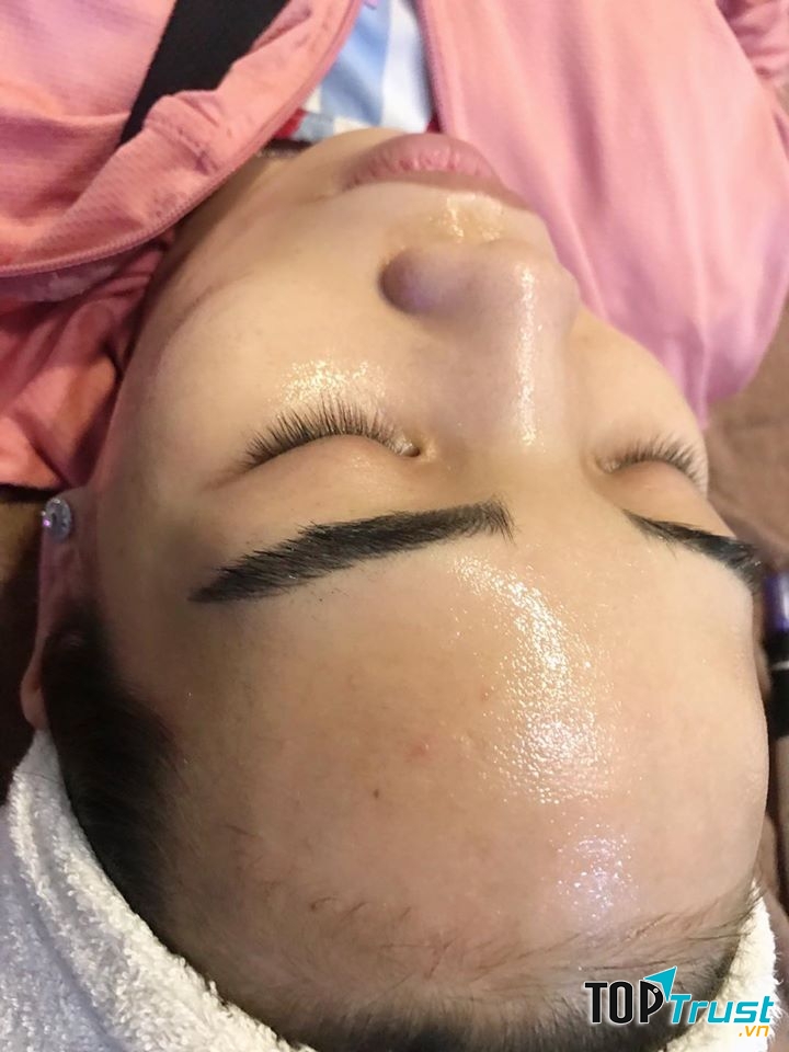 ELLEN SPA - Trung tâm điều trị da