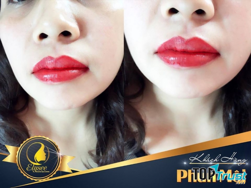 Elysee Beauty Spa Center
