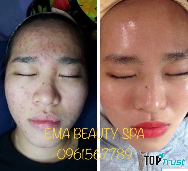 EMA SPA
