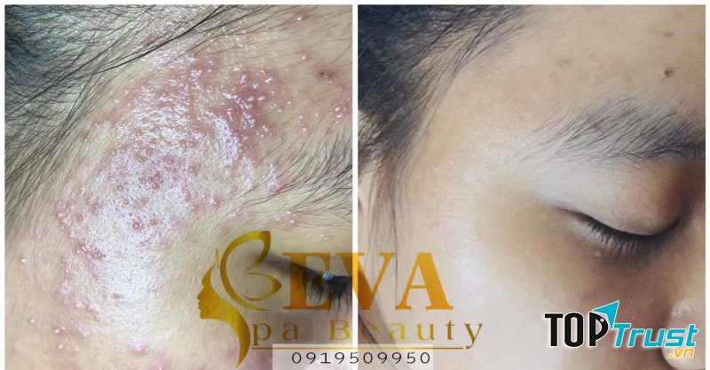 Eva Spa Đà Lạt