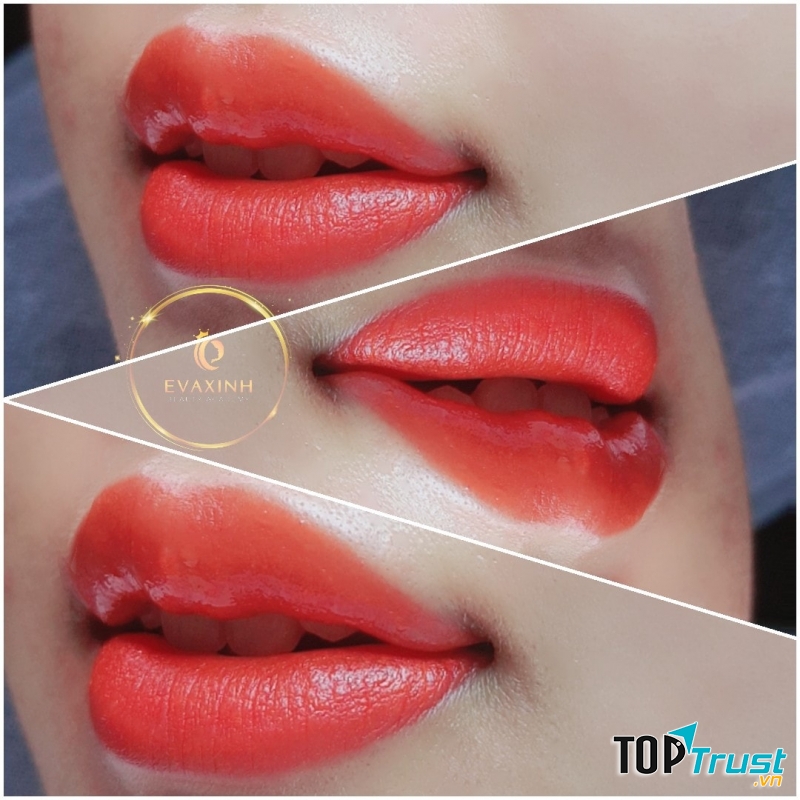 Eva Xinh Spa Hải Phòng