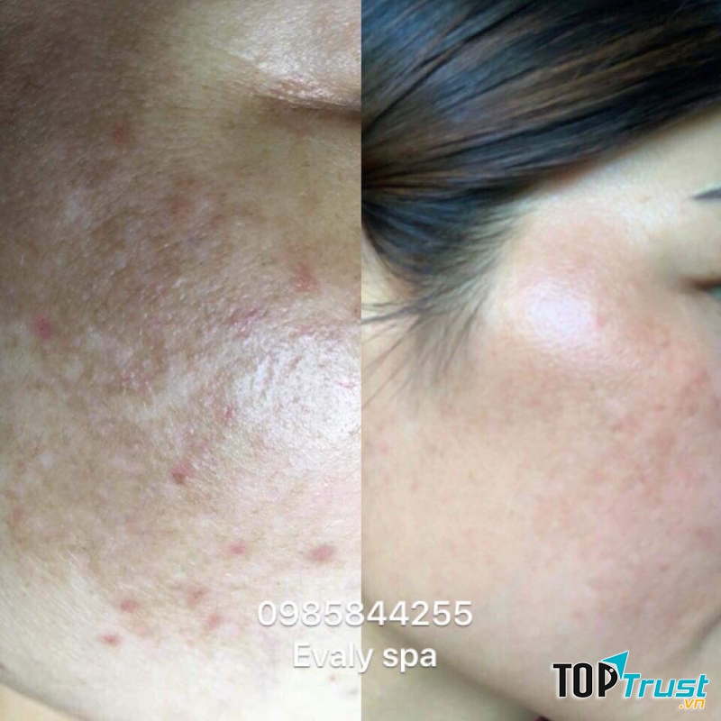 Evaly Spa - Hà Tĩnh