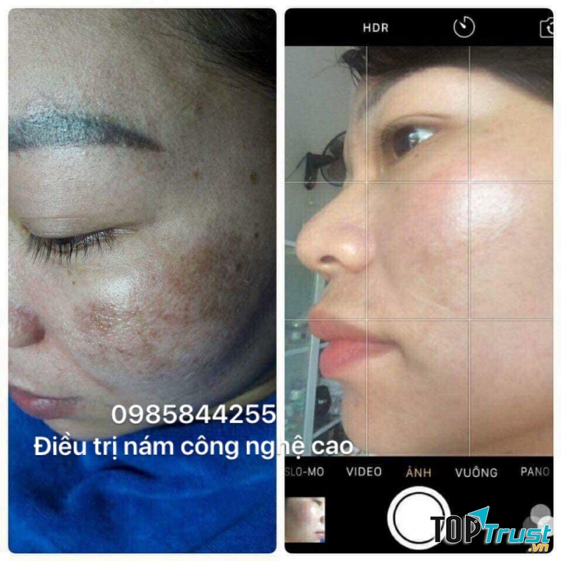 Evaly Spa - Hà Tĩnh