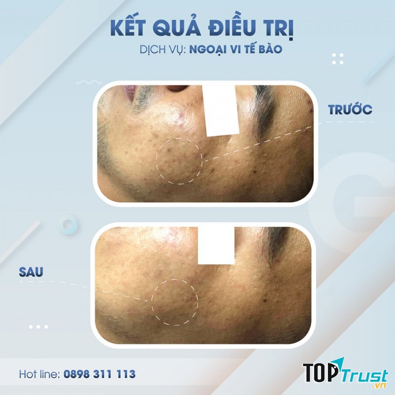 Gà Spa Quy Nhơn