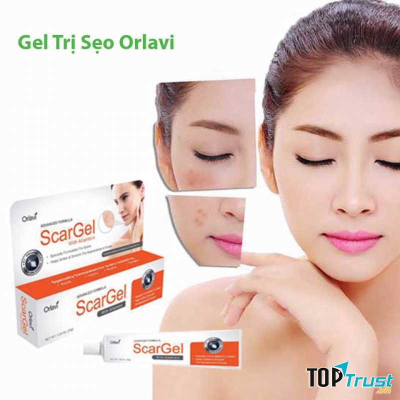 Gel Trị Sẹo Orlavi Scargel