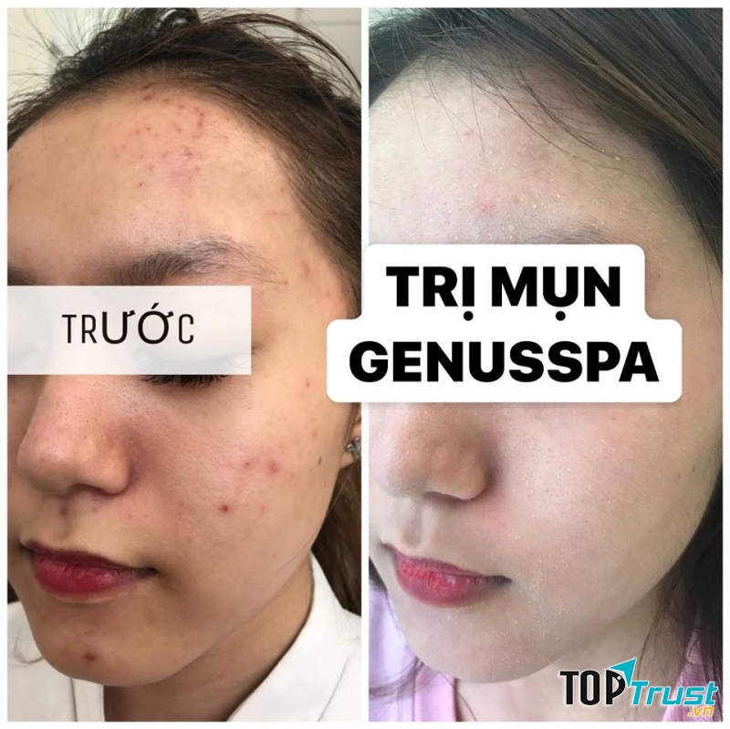 Trương Thu Spa
