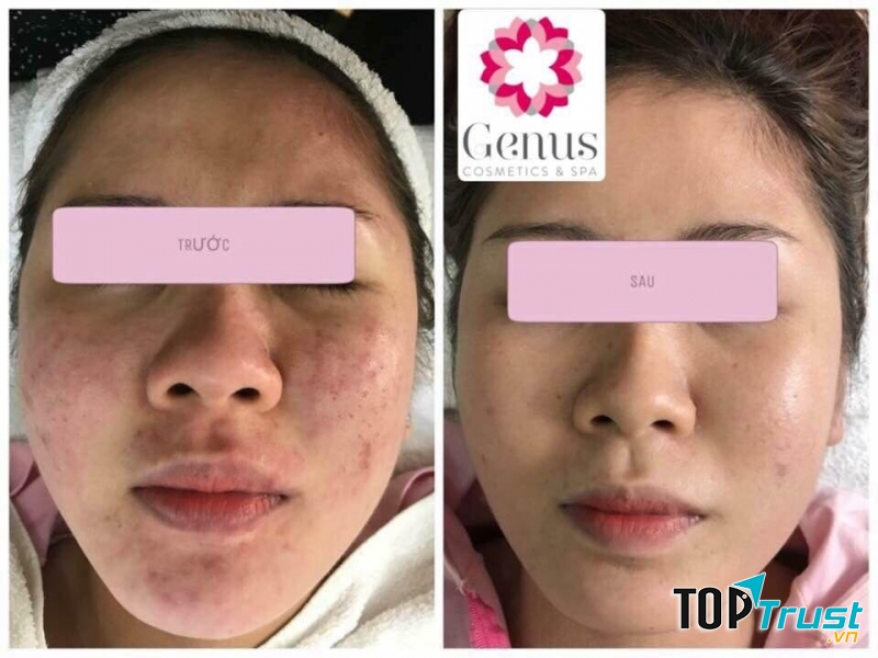 Trương Thu Spa