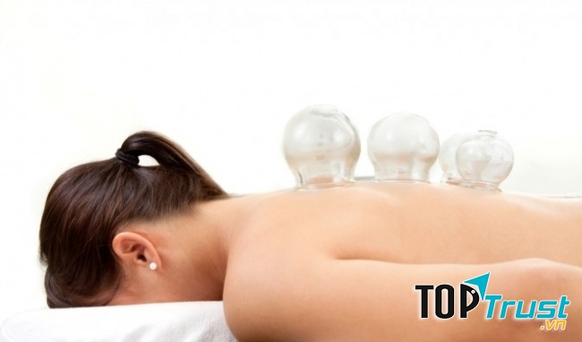 Giác hơi trị đau lưng hiệu quả