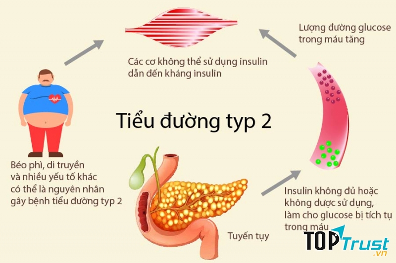Ngủ không đủ giấc cũng có sự liên quan mạnh mẽ đến các tác dụng phụ với lượng đường trong máu