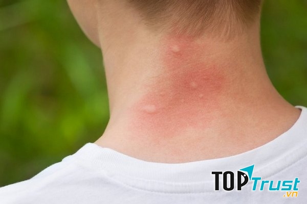 Ảnh minh họa - nguồn internet