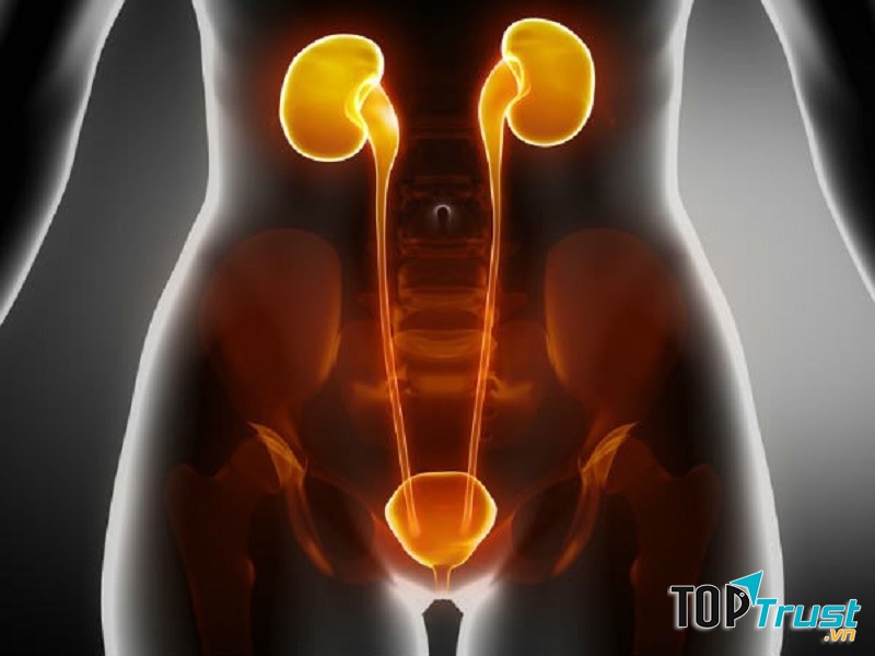 Giảm nguy cơ sỏi thận