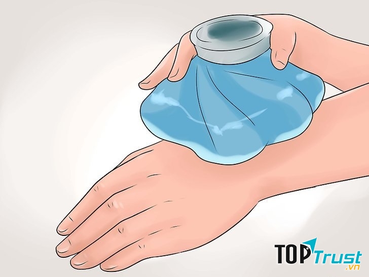 Giảm sưng bằng túi nước lạnh