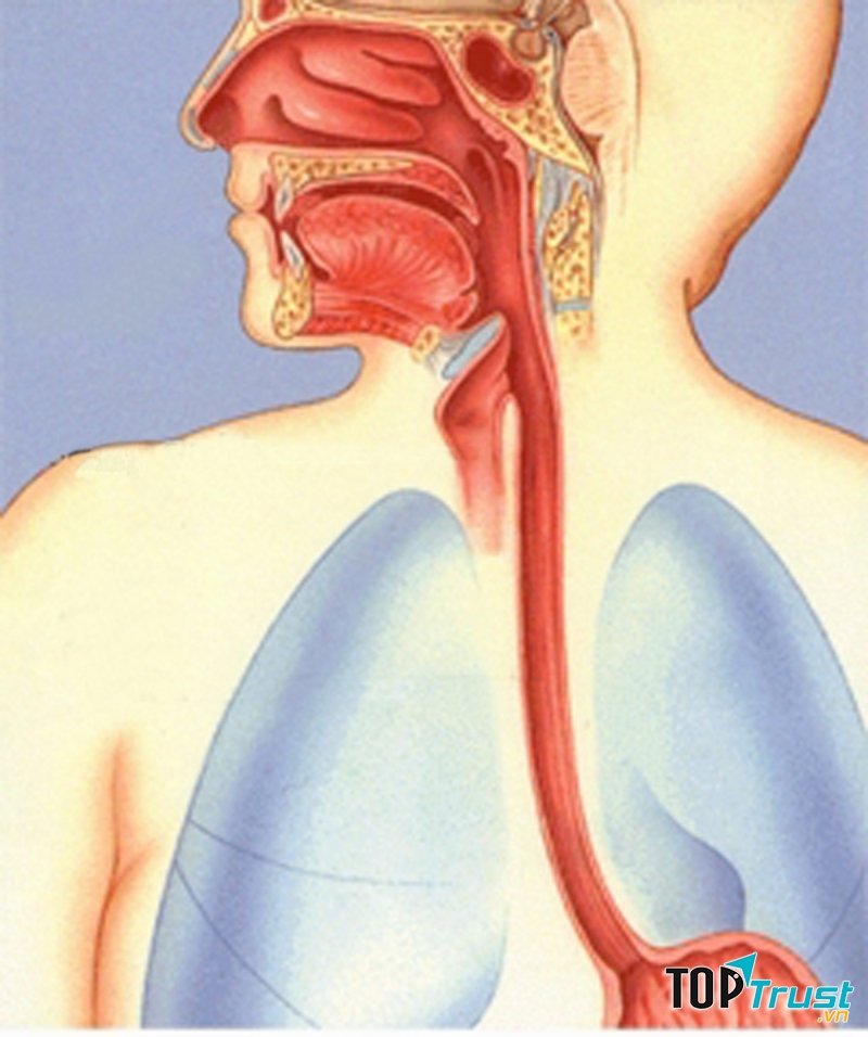 Giảm tĩnh mạch thực quản