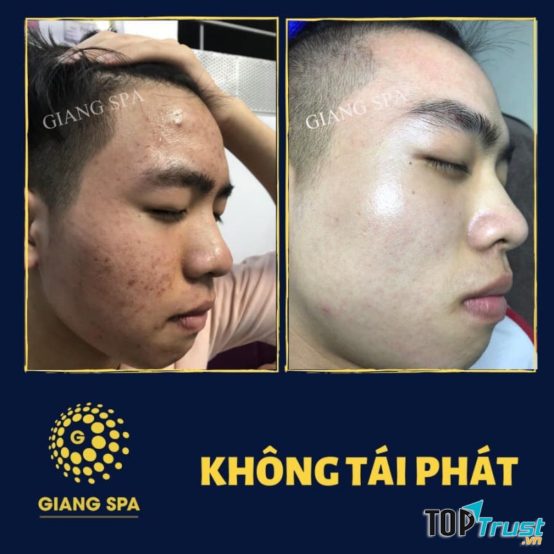 Giang spa