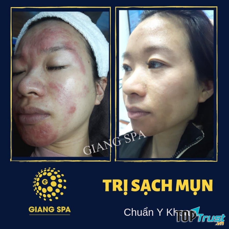 Giang spa