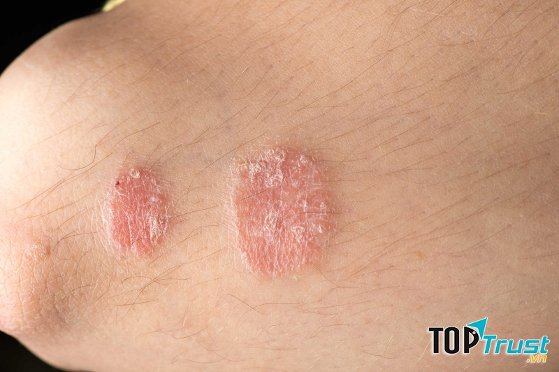 Ảnh minh họa - nguồn internet