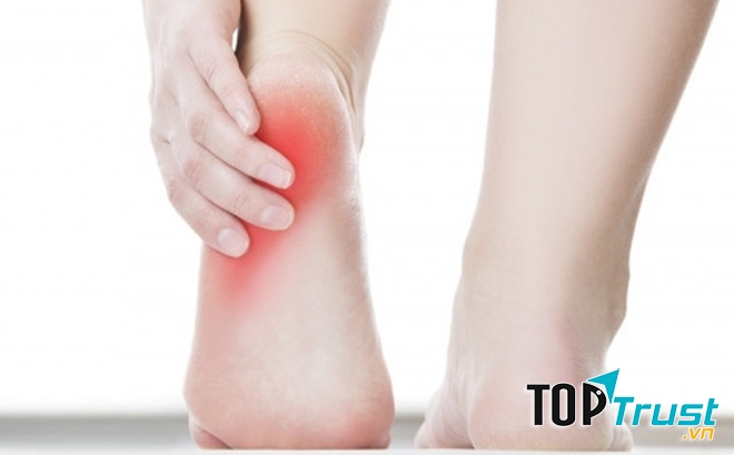 Gót chân đau nhức