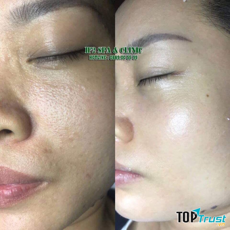 H'2 spa & Clinic