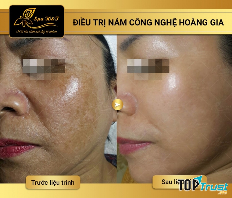 H&T Spa