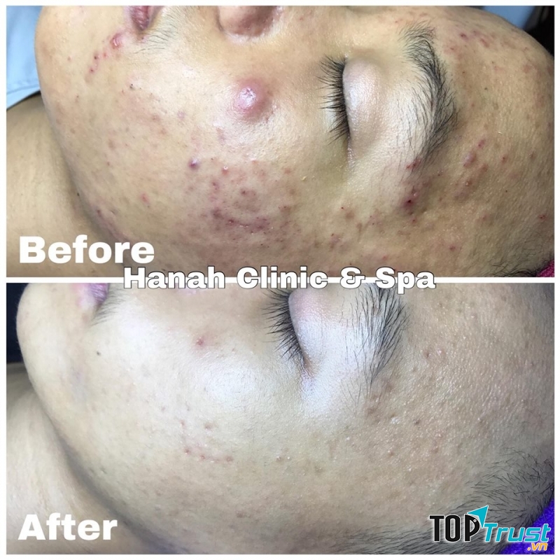 Hanah Clinic - Spa