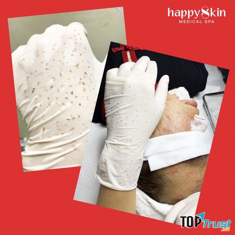 Happy Skin Medical Spa