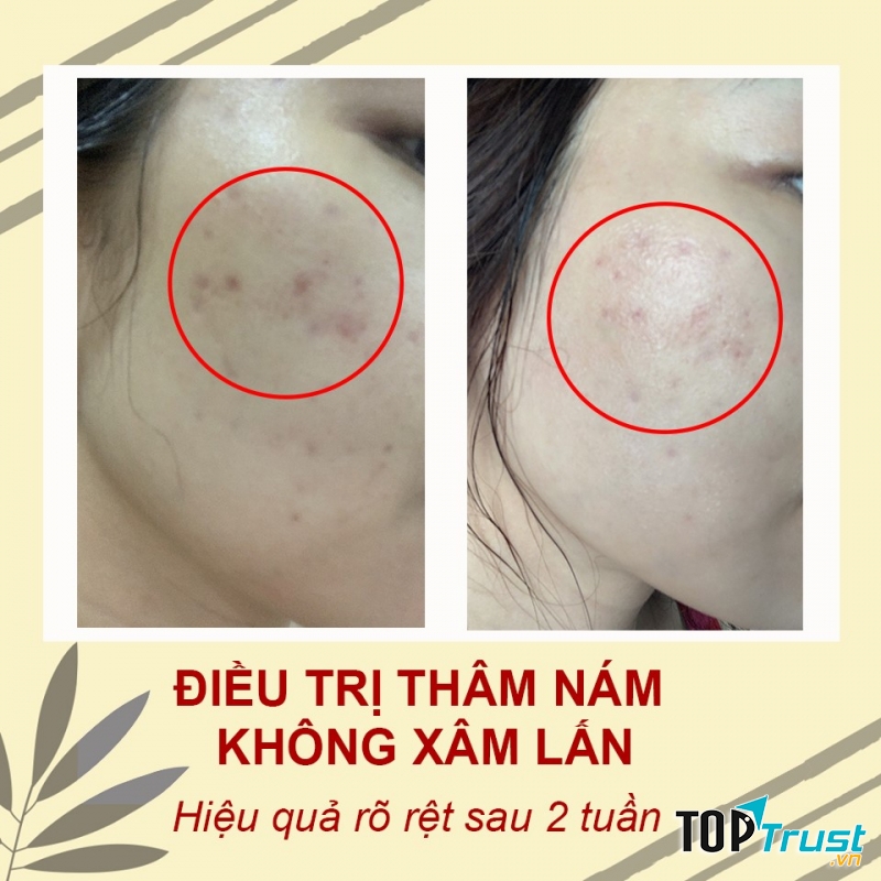 Happy Skin Medical Spa