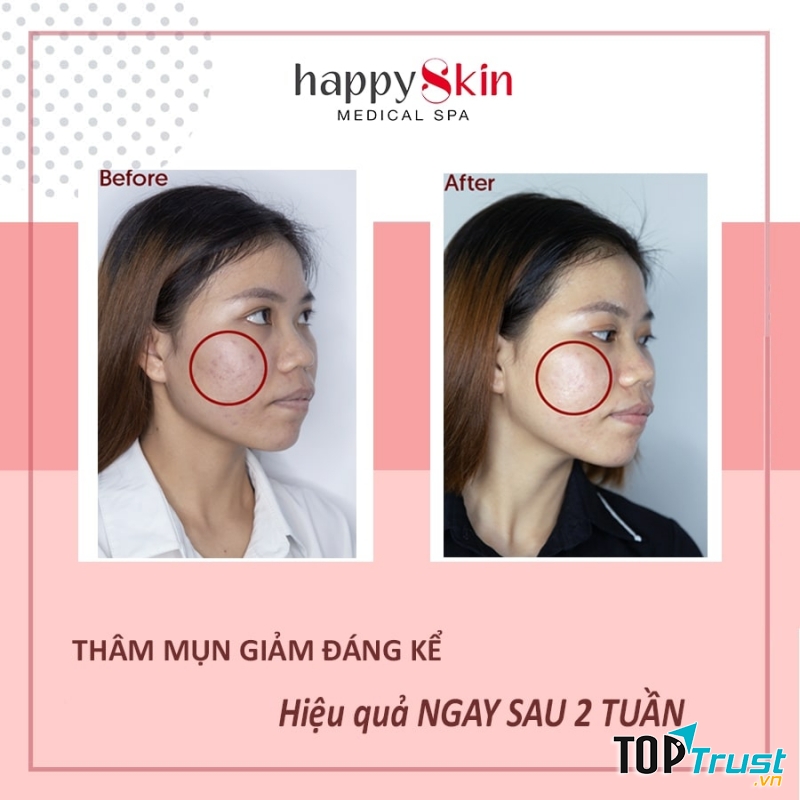 Happy Skin Medical Spa