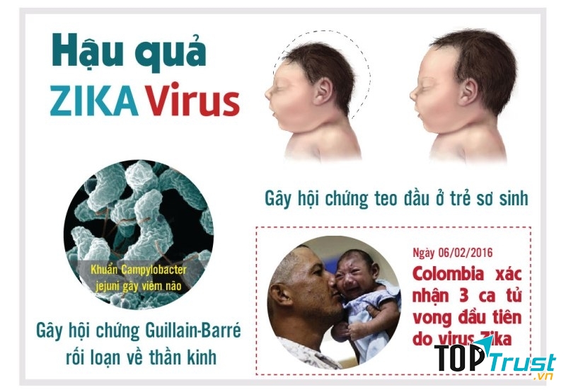 Hậu quả của nhiễm virus Zika