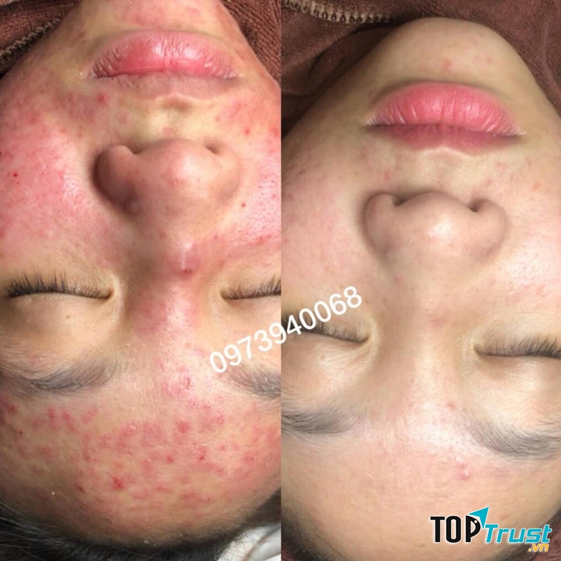 H.E.R June Spa