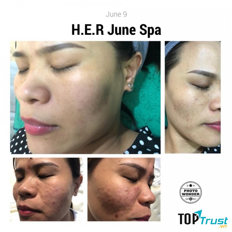 H.E.R June Spa