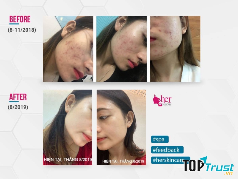 Đẹp hơn với Her Skincare. Makeup. Spa
