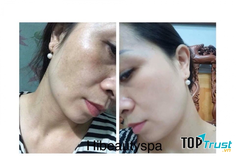 HI Spa