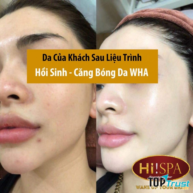 Hi Spa