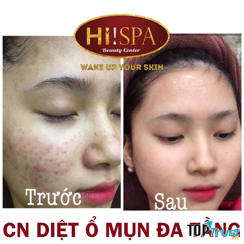Hi Spa