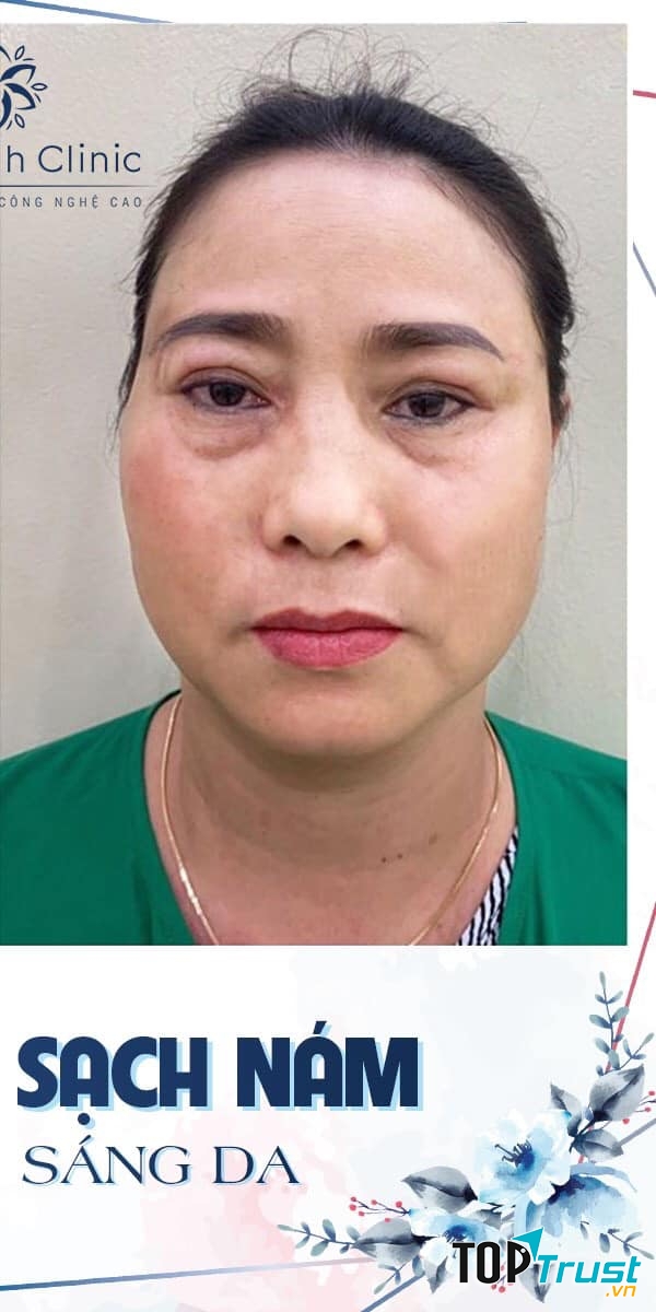 Hiền Anh Beauty