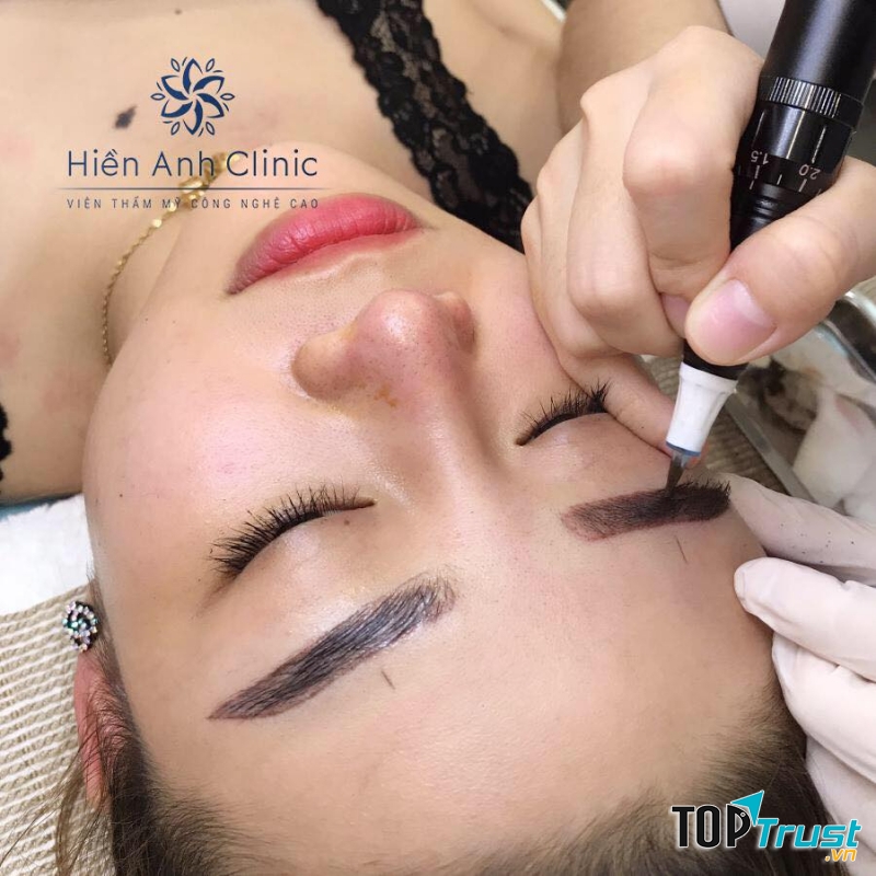 Hiền Anh Clinic - Viện Thẩm Mỹ Công Nghệ Cao