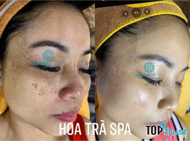 Hoa Trà Beauty & Spa